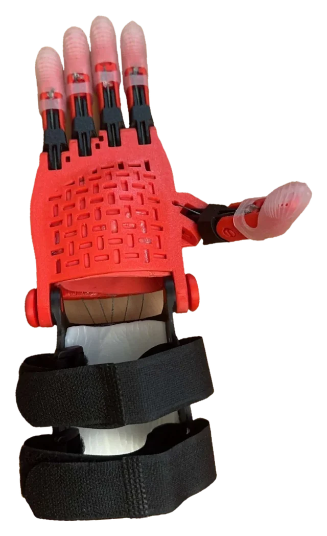The red 3D-printed prosthetic hand seen from the back, with its padded gauntlet, black Velcro straps, and all four fingers extended