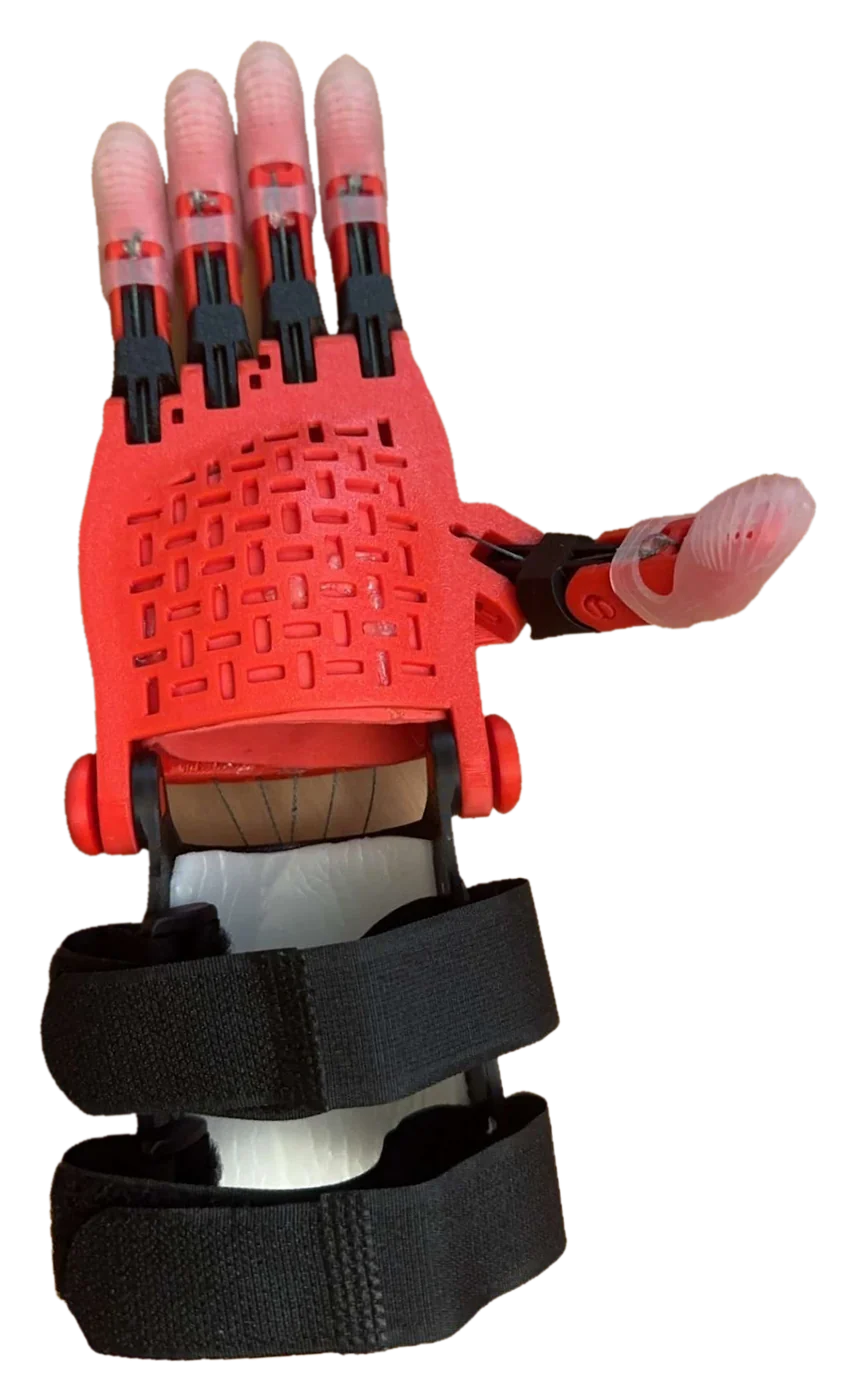 The red 3D-printed prosthetic hand worn on a forearm, seen from the back with black Velcro straps and all four fingers extended