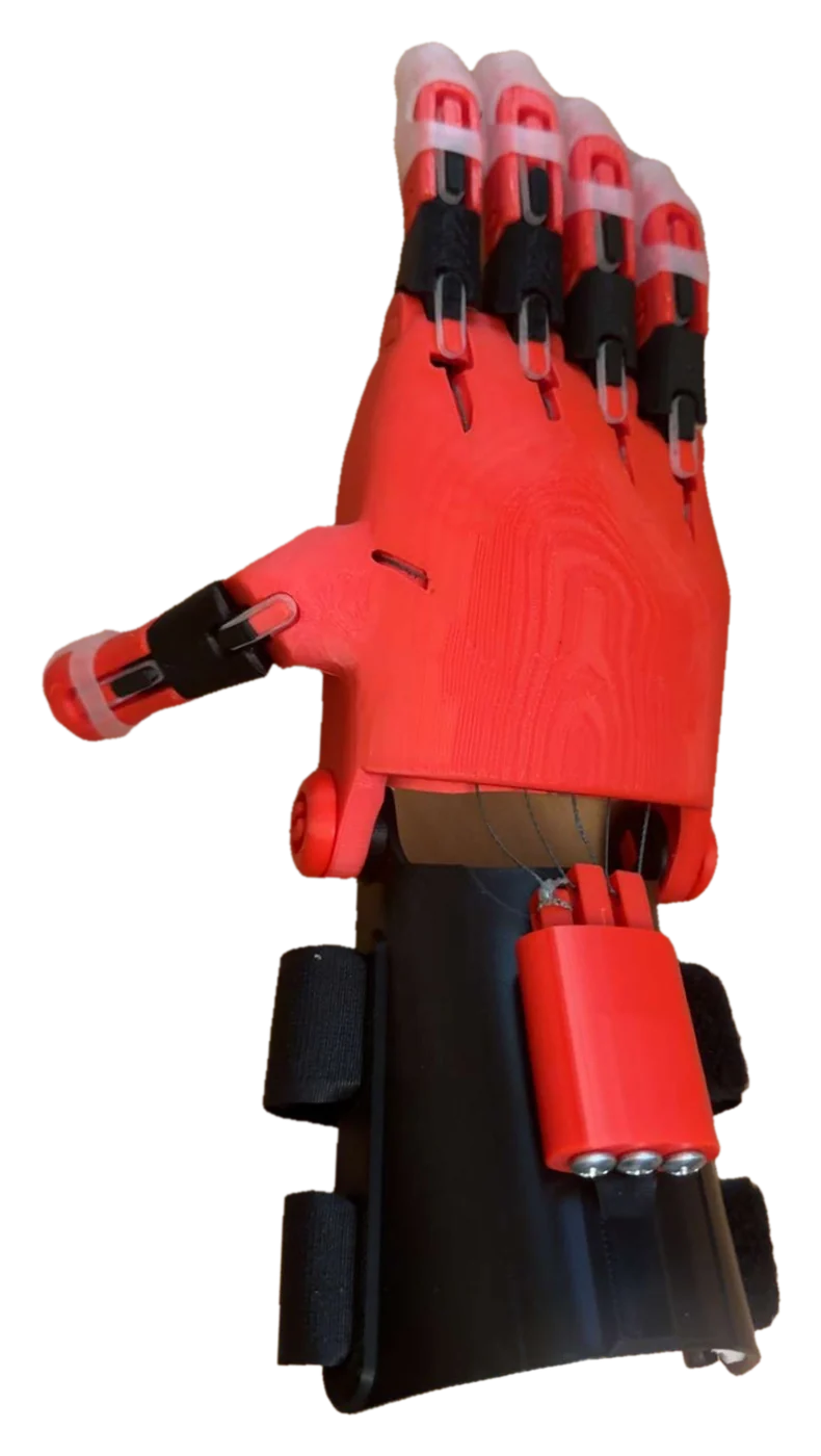 The same prosthetic hand seen from the side, showing the printed palm, the thumb, and the wrist strap